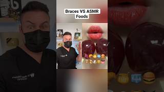 Orthodontist Reacts ASMR Foods VS Braces [upl. by Cloutman721]