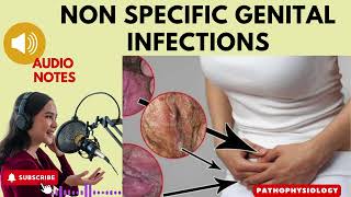 NonSpecific Genital Infections Causes Symptoms and Treatment Audio Notes [upl. by Teresina]