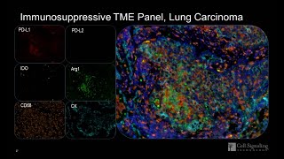 Myeloid Immunosuppression in the Tumor Microenvironment Characterized by SingleMultiplex IHC [upl. by Ytirev]