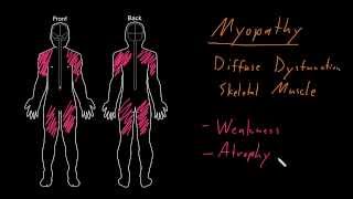 Syndrome Myopathy [upl. by Deerc]