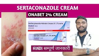 Sertaconazole cream in hindi  Onabet cream  Sertaconazole ointment [upl. by Hamid]