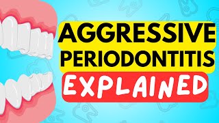 AGGRESSIVE PERIODONTITIS EXPLAINED IN 5 MINUTES  CAUSE DIAGNOSIS RISK FACTORS AND TREATMENT [upl. by Ahseken]