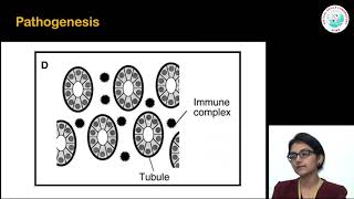 Interstitial Nephritis [upl. by Chaiken]