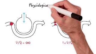 What defines physiological dead space [upl. by Anjanette]