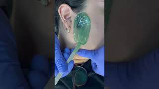 Professional sideburn wax performed by me Using Nacach hard green wax esthetician waxing [upl. by Repsag]