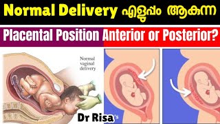 പ്രസവം എളുപ്പമാകുന്ന Placental Position  Anterior amp Posterior Placenta [upl. by Eidoow]