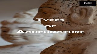 Types of Acupuncture TCM [upl. by Dede]