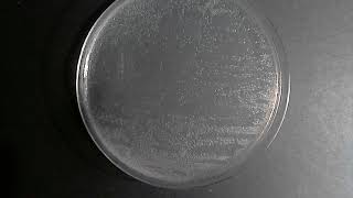 Serratia marcescens time lapse and pigment production prodigiosin [upl. by Stouffer]