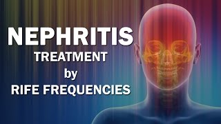 Nephritis  RIFE Frequencies Treatment  Energy amp Quantum Medicine with Bioresonance [upl. by Cazzie403]