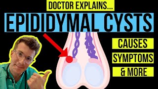 Doctor explains TESTICULAR LUMPS PART 1  EPIDIDYMAL CYSTS causes symptoms and treatments [upl. by Nonez103]