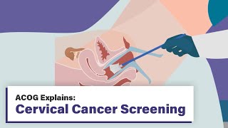 ACOG Explains Cervical Cancer Screening [upl. by Tooley]