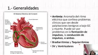 Arritmias  Medicina Interna  Reforzamiento Académico UCM [upl. by Aderb725]