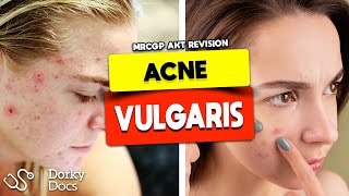 Acne Vulgaris  The MRCGP AKT Exam Revision I Dorky Docs [upl. by Oninrutas]