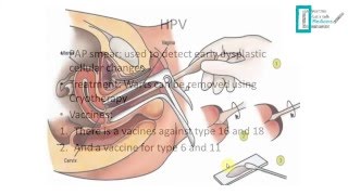 STDs Overview [upl. by Dniren674]