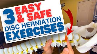 3 EASY amp SAFE L5S1 Disc Herniation Exercises amp L4L5  Dr Marc Dupuis Chiropractor in Sanford ME [upl. by Wiedmann]