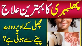 Vitiligo Skin Disease Treatment  Phulbari Ka ilaj  Vitiligo Starting Stage  Vitiligo Treatment [upl. by Malia]