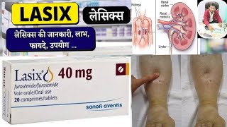 Lasix 40 mg tablet uses in hindi  Lasix Tablet  Furosemide 40 mg [upl. by Sidoon]