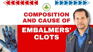 Embalmers Clots EXPOSED Whats Really Causing Them [upl. by Lopez]