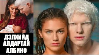 📌Дэлхийд алдартай ALBINO хүн… Яг л ANGEL шиг 46 [upl. by Yllib107]