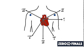 Understanding ECG Axis and Axis Deviation [upl. by Leuqcar632]