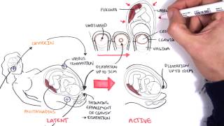 Obstetrics  Stages of Labour [upl. by Mohandis206]