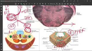 33 Locked in Syndrome Medial Pontine Syndrome [upl. by Atinev]