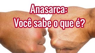 Anasarca Significado  O que é  Causas e Tratamentos [upl. by Karin]