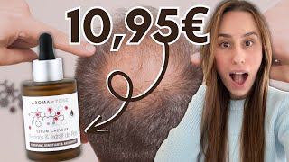 CALVITIE CHUTE DE CHEVEUX  JE TESTE LE SÉRUM CHEVEUX AROMAZONE À 1095€ [upl. by Suki61]