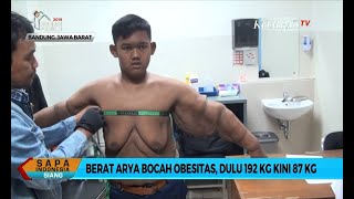 Berat Badan Turun Lebih dari 100 Kg Arya Permana Akan Operasi Plastik untuk Buang Kulit Gelambir [upl. by Efrem]