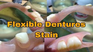 Flexible Dentures Stain Removal [upl. by Ytirahs]