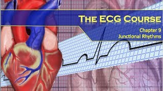 The ECG Course  Junctional Rhythms [upl. by Lister]