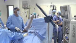 Shoulder Arthroscopy Surgery [upl. by Nimrak]