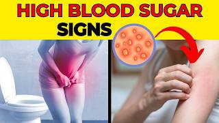 High Blood Sugar 10 ALARMING Symptoms You Shouldnt Ignore [upl. by Anastasia]