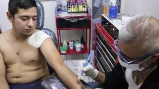 eliminación de tatuaje usando un electrobisturí [upl. by Veedis629]