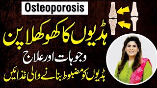 Osteoporosis Causes Symptoms and Treatment  Best Food for Osteoporosis  Dr Fareeha Tariq [upl. by Noslrac809]