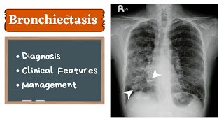 Bronchiectasis  Clinical features amp Management [upl. by Ades]