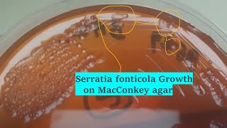 Serratia fonticola Colony Morphology on Macconkey agar of BAL sample [upl. by Barcellona]