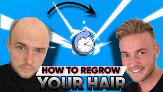 Regrow Your HAIRS within a Month 100 GRANTED  hair loss [upl. by Sabas]