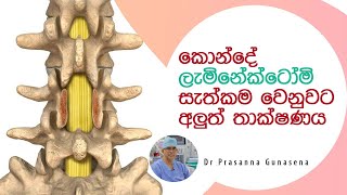 New Technique to replace spinal laminectomy surgery [upl. by Winters]