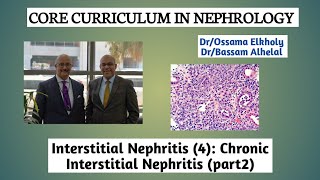 Interstitial Nephritis4 Chronic Interstitial Nephritis part 2 DrOssama Elkholy [upl. by Rimaa]