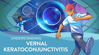 Understanding Vernal Keratoconjunctivitis VKC [upl. by Marchal412]