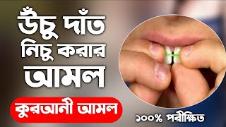 উঁচু দাঁত নিচু করার আমল দোয়া উপায়  ucu dat nichu korar amol Doah upai  উঁচু দাঁত নিচু করার উপায় [upl. by Yentrok]