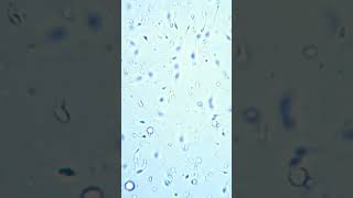 How sperm looks under a microscope shorts [upl. by Edroi]