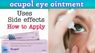 ocupol eye ointment  ocupol eye ointment how to apply  ocupol eye ointment uses in hindi [upl. by Nlycaj]