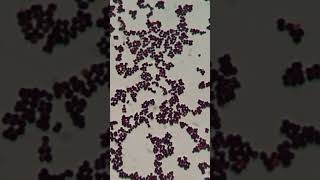 Gram Staining Insights Identifying Staphylococcus hominis as GPC in Singles Pairs and Clusters [upl. by Casanova]