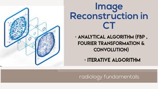 CT Image Reconstruction  CT RECONSTRUCTION FBP ITRATIVE RECONCTRUCTION  radiology fundamentals [upl. by Laspisa]