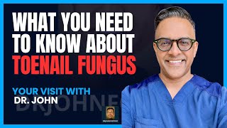 What You Need to Know About Toenail Fungus [upl. by Marozik]