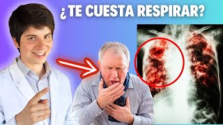 FIBROSIS PULMONAR IDIOPÁTICA ► SÍNTOMAS FISIOPATOLOGÍA DIAGNÓSTICO y TRATAMIENTO en 11 MINUTOS 😉 [upl. by Basham]