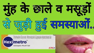 Heximetro antiseptic Mouth Gel Uses in Hindi [upl. by Enyala]