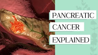 Pancreatic Cancer The Silent Killer You Should Worry About [upl. by Frederick]